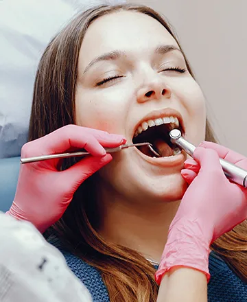 populer_hizmetler_kompozit_dolgu