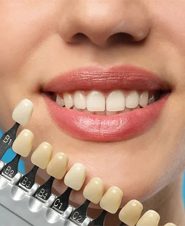 populer_hizmetler_lamine